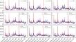 Corrected Triple Correction Method, CNN and Transfer Learning for Prediction the Realized Volatility of Bitcoin and E-Mini S&P500