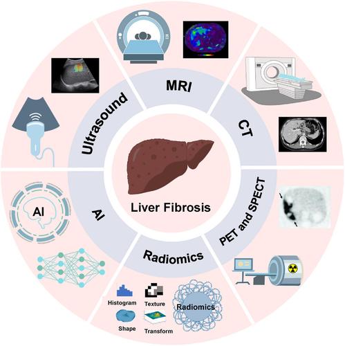 Advancements of non‐invasive imaging technologies for the diagnosis and staging of liver fibrosis: Present and future