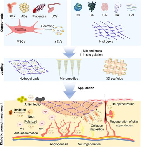 Hydrogels loaded with MSC-derived small extracellular vesicles: A novel cell-free tissue engineering system for diabetic wound management