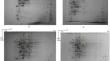 A proteomic study to elucidate molecular relationships between iron, oxidative stress and polyphosphate in Streptomyces coelicolor A3(2)