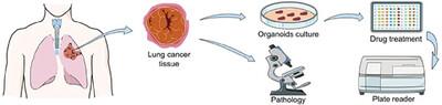 Efficacy Evaluation of Adjuvant Therapeutic Drugs Against Early and Middle Stage Non-Small Cell Lung Cancer Organoids