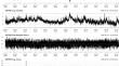 Measuring and Forecasting Stock Market Volatilities with High-Frequency Data