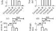 Neuroprotective Effect of Ganoderic Acid against Focal Ischemic Stroke Induced by Middle Cerebral Artery Occlusion in the Rats via Suppression of Oxidative Stress and Inflammation