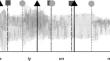 The role of native language and beat perception ability in the perception of speech rhythm : Native language, beat perception, and speech rhythm perception.
