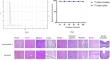 The first-in-human preclinical evaluation of the new probe [123I]I-PSMA-7 for real-time intraoperative targeted biopsy and SPECT/CT imaging in prostate cancer.