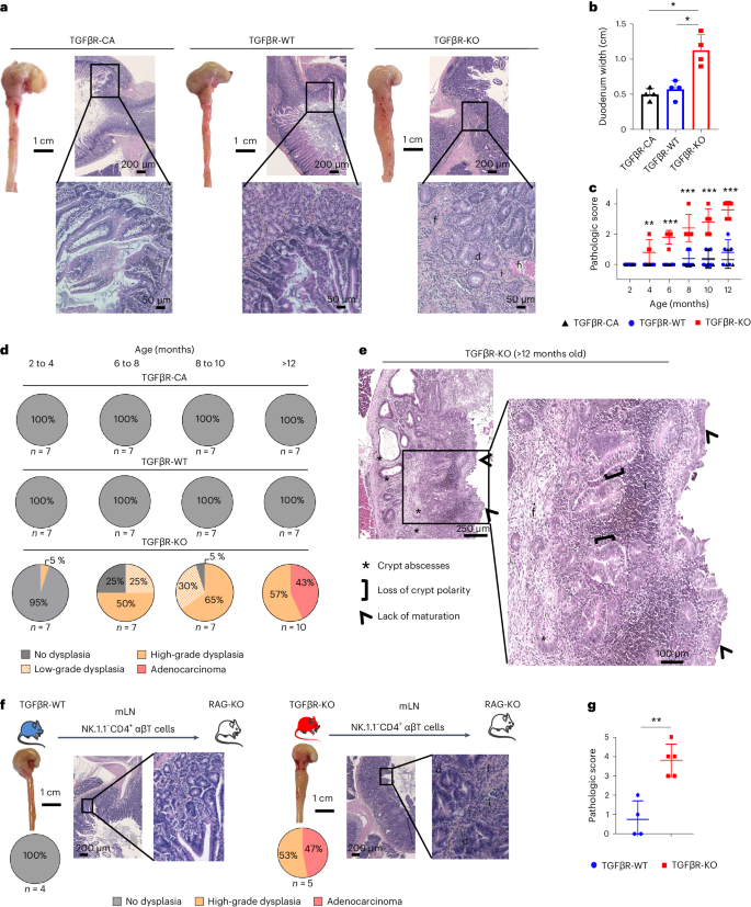 An intestinal TH17 cell-derived subset can initiate cancer