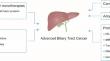 Recent Advances in Immunotherapy for Advanced Biliary Tract Cancer