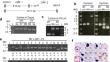 CRISPR/Cas9-mediated resurrection of tobacco NB-LRR class virus resistance gene from a susceptible allele with partial duplication