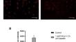 The therapeutic efficacy of 5-ALA based photodynamic therapy and chemotherapy combination in triple negative breast cancer cells.