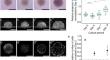 Spatiotemporal analysis of multi-scale cell structure in spheroid culture reveals hypertrophic chondrocyte differentiation.