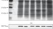 The Dynamics of Cytoplasmic HSP70 and Chloroplast HSP70B Chaperone Levels under Heat Stress Differs in Three Pumpkin Species with Different Stress Resistance