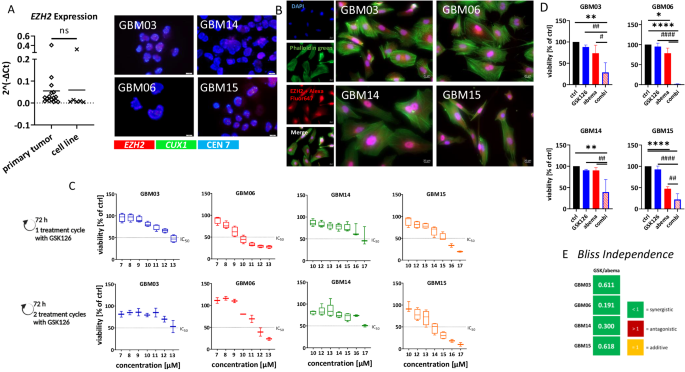 Combined inhibition of EZH2 and CDK4/6 perturbs endoplasmic reticulum-mitochondrial homeostasis and increases antitumor activity against glioblastoma