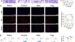 CD8 + CD103 + iTregs protect against ischemia-reperfusion-induced acute kidney Injury by inhibiting pyroptosis