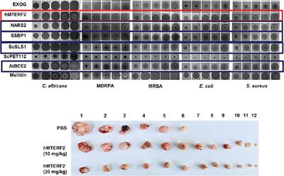 Mitochondrial N-Terminal Signal Sequences as Novel Antimicrobial and Annticancer Peptides