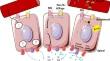 Advances in the selection and timing of postoperative radioiodine treatment in patients with differentiated thyroid carcinoma.