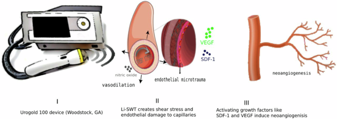 Successful treatment of hard flaccid syndrome with multimodal therapy: a case report study.