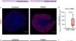 Galectin-3 protects distal convoluted tubules in rhabdomyolysis-induced kidney injury.