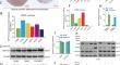 PARK2 suppresses the proliferation of high-grade serous ovarian carcinoma via inducing the proteasomal degradation of ZNF703.