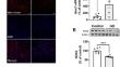 β-Hydroxybutyrate Improves the Redox Status, Cytokine Production and Phagocytic Potency of Glucose-Deprived HMC3 Human Microglia-like Cells.