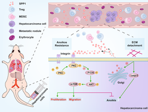 The resistance to anoikis, mediated by Spp1, and the evasion of immune surveillance facilitate the invasion and metastasis of hepatocellular carcinoma