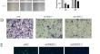 Correction to: Osimertinib resistance prognostic gene signature: STRIP2 is associated with immune infiltration and tumor progression in lung adenocarcinoma.