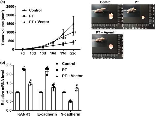 Pterostilbene exerts anti-lung squamous cell carcinoma function by suppressing the level of KANK3