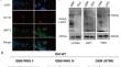 Glutamine deprivation in glioblastoma stem cells triggers autophagic SIRT3 degradation to epigenetically restrict CD133 expression and stemness