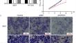 Knockdown of CPSF4 Inhibits Bladder Cancer Cell Growth by Upregulating NRF1.