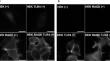 Reciprocal effect on lateral diffusion of receptor for advanced glycation endproducts and toll-like receptor 4 in the HEK293 cell membrane