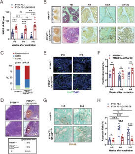 GATA2 promotes castration-resistant prostate cancer development by suppressing IFN-β axis-mediated antitumor immunity