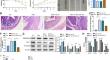 E3 ubiquitin ligase RNF180 mediates the ALKBH5/SMARCA5 axis to promote colon inflammation and Th17/Treg imbalance in ulcerative colitis mice.