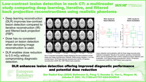 Low-contrast lesion detection in neck CT: a multireader study comparing deep learning, iterative, and filtered back projection reconstructions using realistic phantoms.