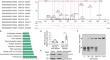 LINC00894 Regulates Cerebral Ischemia/Reperfusion Injury by Stabilizing EIF5 and Facilitating ATF4-Mediated Induction of FGF21 and ACOD1 Expression.