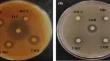 In vitro antifungal activity analysis of Streptomyces sp. strain 196 against Candida albicans and Aspergillus flavus