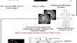 Brain tumor detection in combined 3D MRI and CT images using Dictionary learning based Segmentation and Spearman Regression