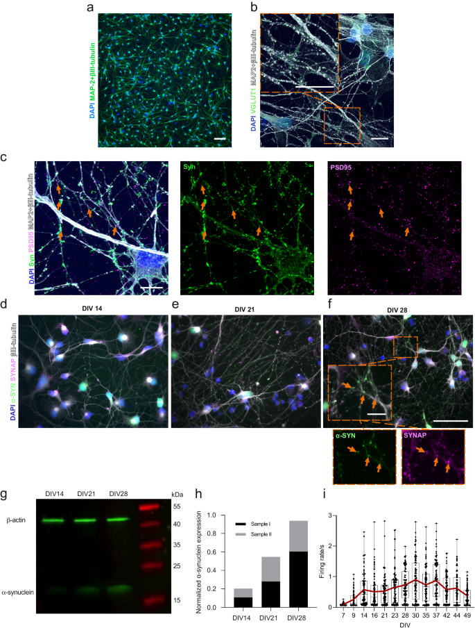 Human tripartite cortical network model for temporal assessment of alpha-synuclein aggregation and propagation in Parkinson's Disease.