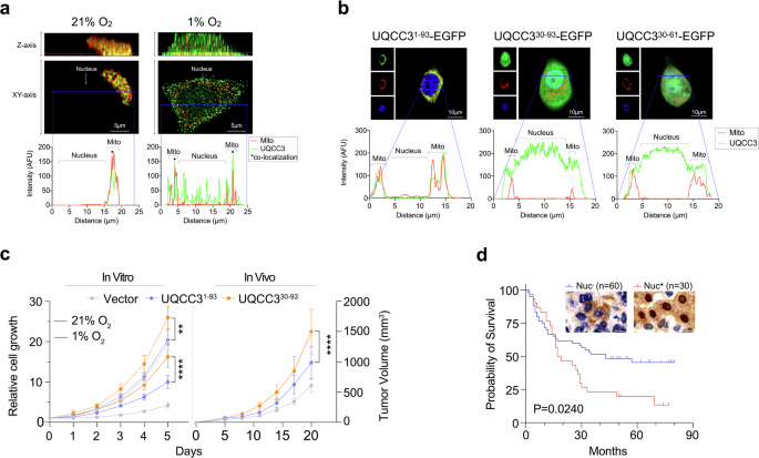 Hypoxia-induced nuclear localization of ubiquinol-cytochrome-c reductase complex assembly factor 3 (UQCC3) in hepatocellular carcinoma.