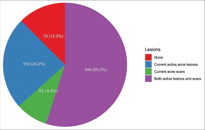 Acne scars impact on the quality of life and the willingness to pay for treatments among adults in Riyadh, Saudi Arabia: A cross-sectional study.