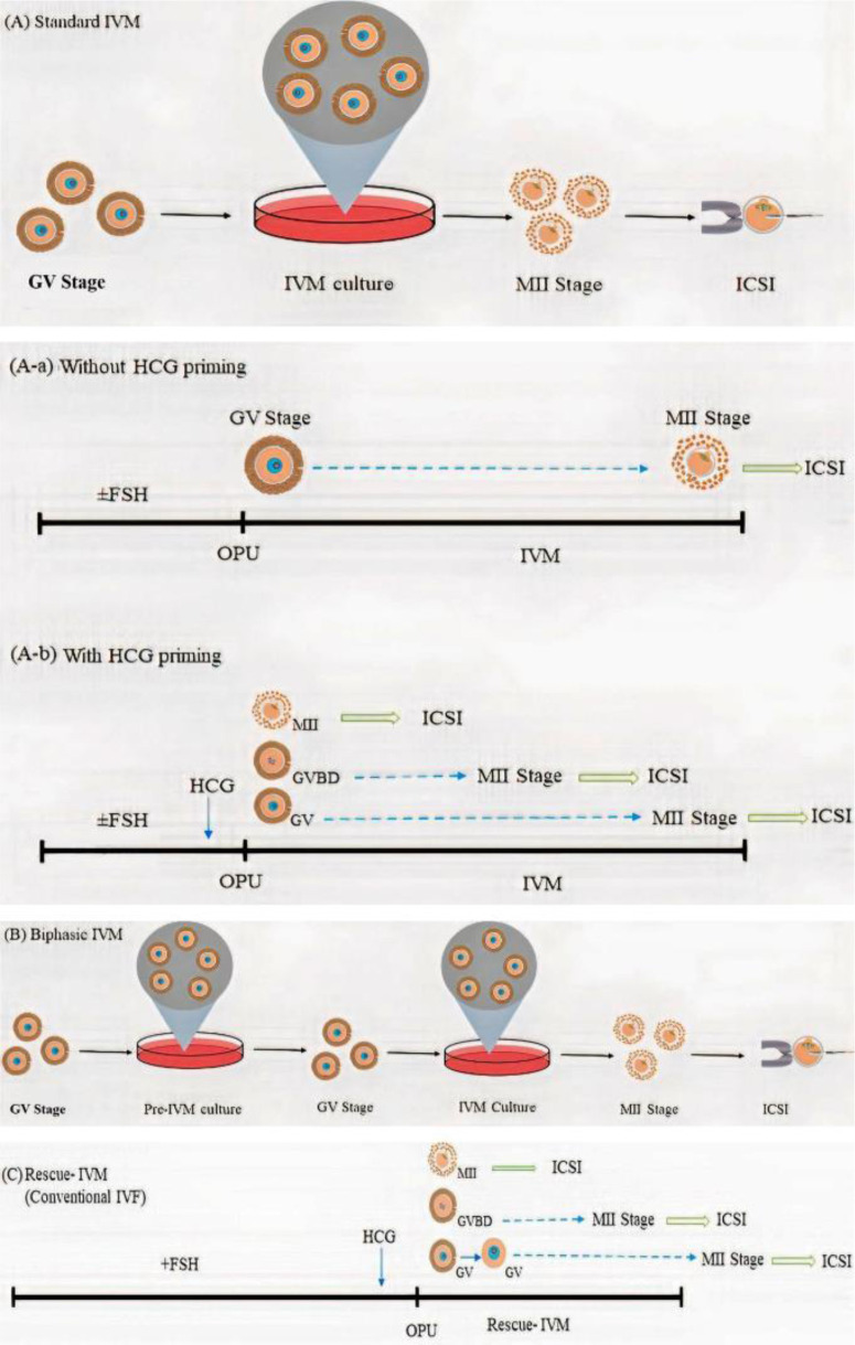 Exploring the Potential of <i>In vitro</i> Maturation (IVM) of Oocytes: Indications, Applications, and Treatment Protocols.