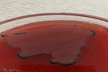 Prevalence and Phenotypic Characterization of Antibiotic-resistant <i>Enterococcus Species</i> Isolated from Chicken Faecal Samples in Accra, Ghana.