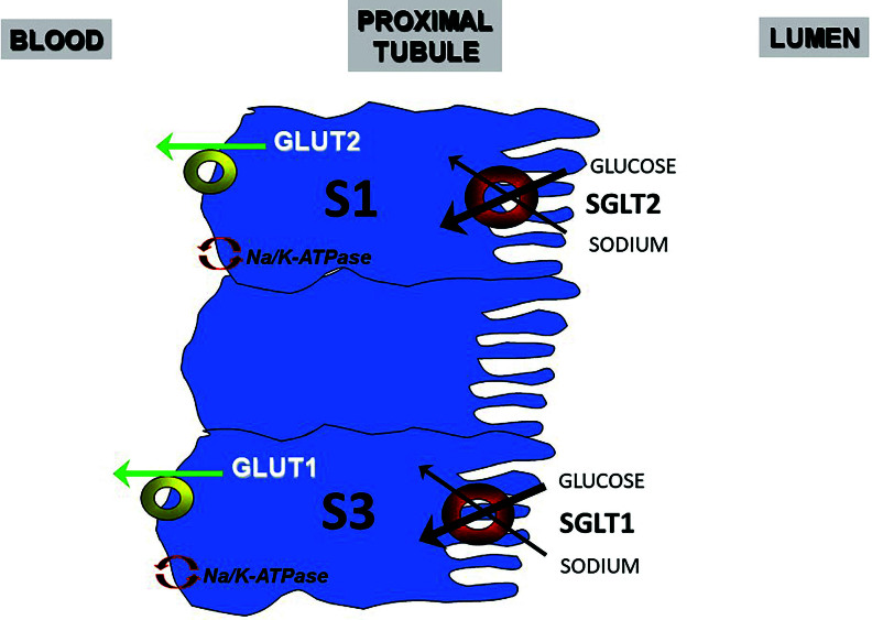 Sodium-glucose cotranspor ter 2 (SGLT2) inhibitors in nephrolithiasis: should we "gliflozin" patients with kidney stone disease?