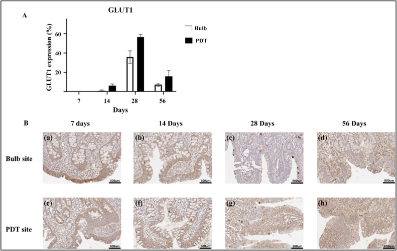 Highly functional duodenal stent with photosensitizers enables photodynamic therapy for metabolic syndrome treatment: Feasibility and safety study in a porcine model.