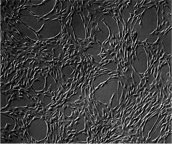Stem cell therapy in diabetic men with erectile dysfunction: a 24-month follow-up of safety and efficacy of two intracavernous autologous bone marrow derived mesenchymal stem cells injections, an open label phase 2 clinical trial.