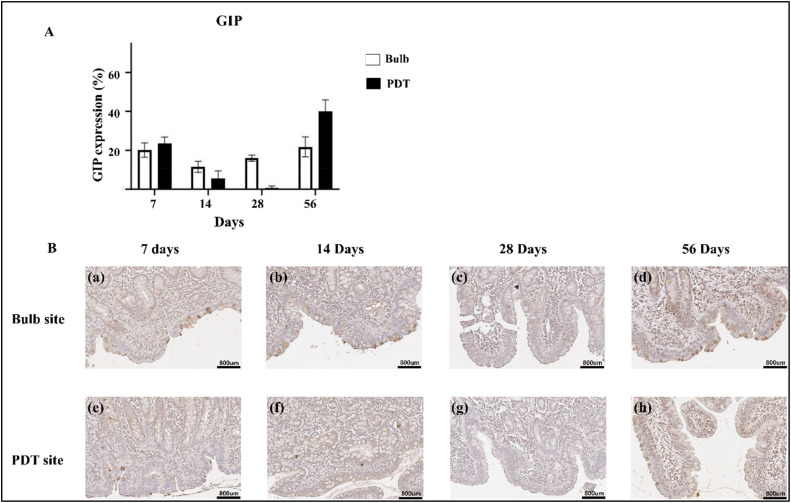 Highly functional duodenal stent with photosensitizers enables photodynamic therapy for metabolic syndrome treatment: Feasibility and safety study in a porcine model.