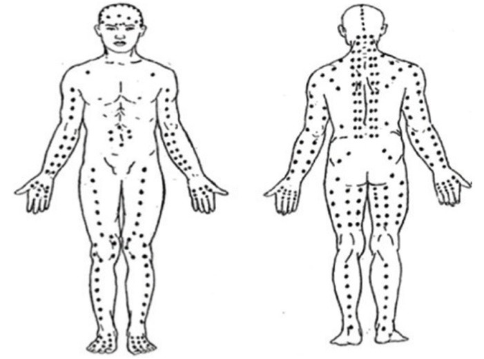 Efficacy of traditional Thai massage as adjunctive therapy in patients with major depressive disorder.