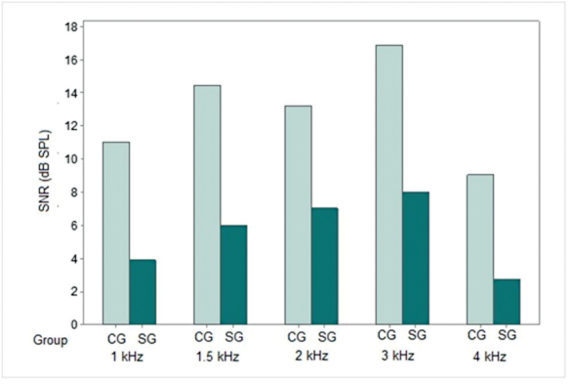 Peripheral Auditory Pathway and ABR Characterization in Adults with Williams Syndrome.