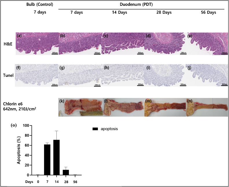 Highly functional duodenal stent with photosensitizers enables photodynamic therapy for metabolic syndrome treatment: Feasibility and safety study in a porcine model.