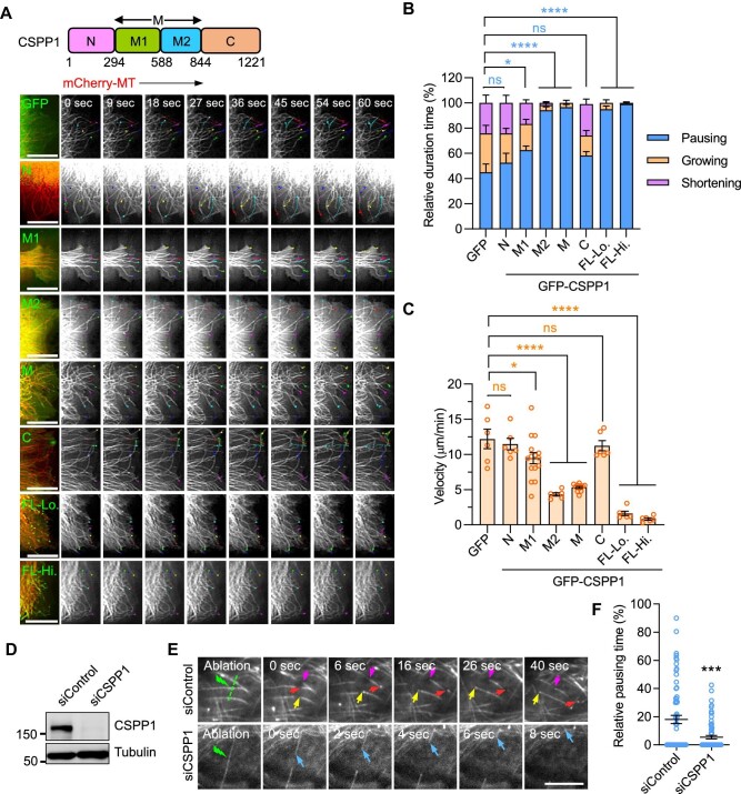 CSPP1 stabilizes microtubules by capping both plus and minus ends.