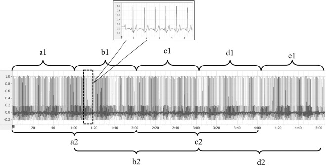 Exploring Ultra-short Heart Rate Variability Metrics in Patients with Diabetes Mellitus: A Reliability Analysis.