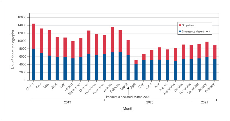 Streamlining lung cancer management in Nova Scotia amid COVID-19: pooled triaging for expedited curative-intent oncologic surgery.